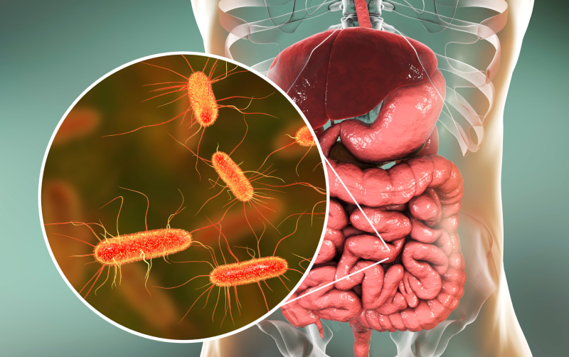 Sindrom de suprapopulare microbiana (SIBO)